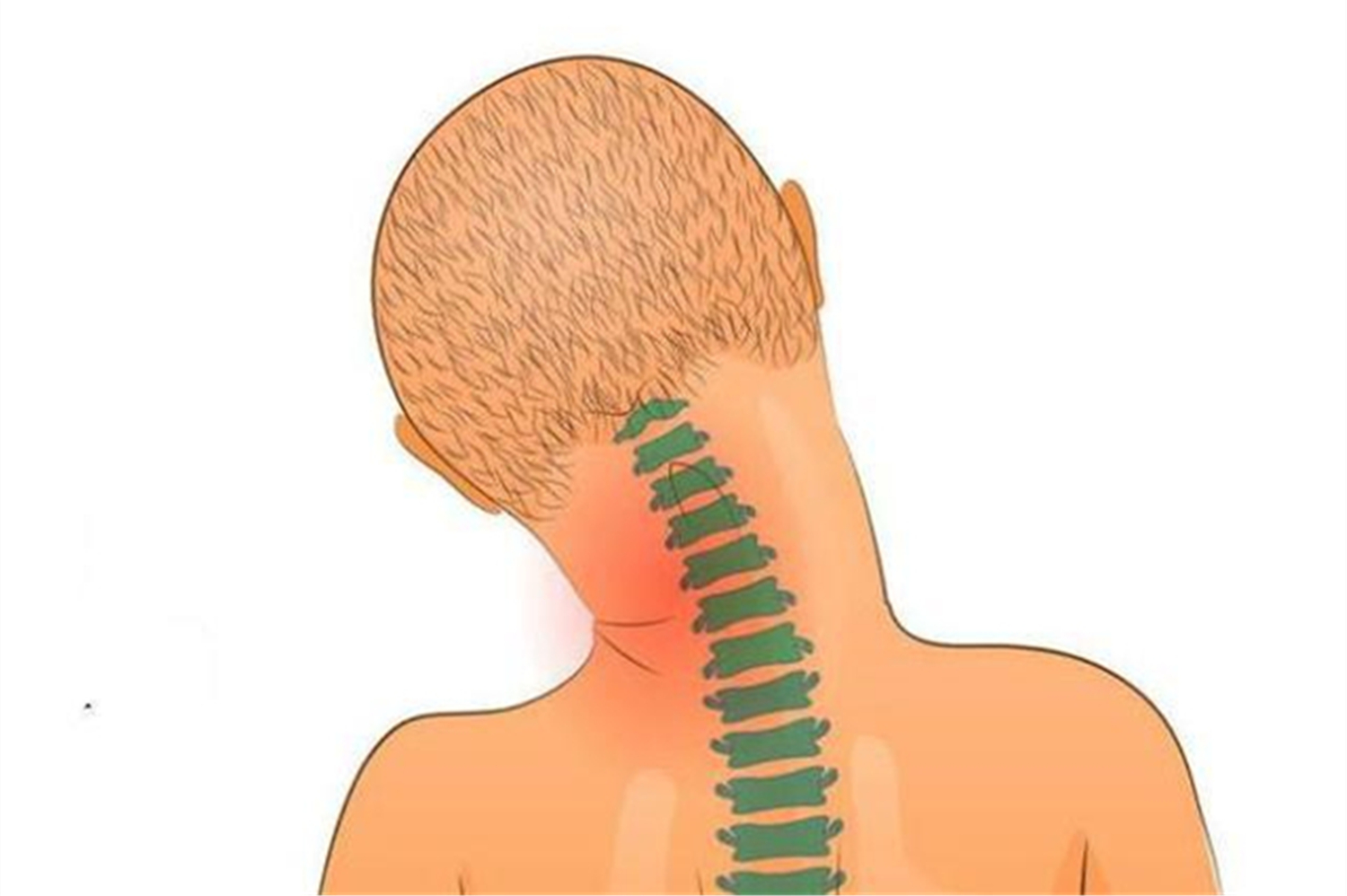 宝宝的脖子总是往一侧歪,可能是婴儿斜颈,越早治疗越好纠正