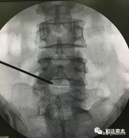 微创骨科医疗器械初步分析