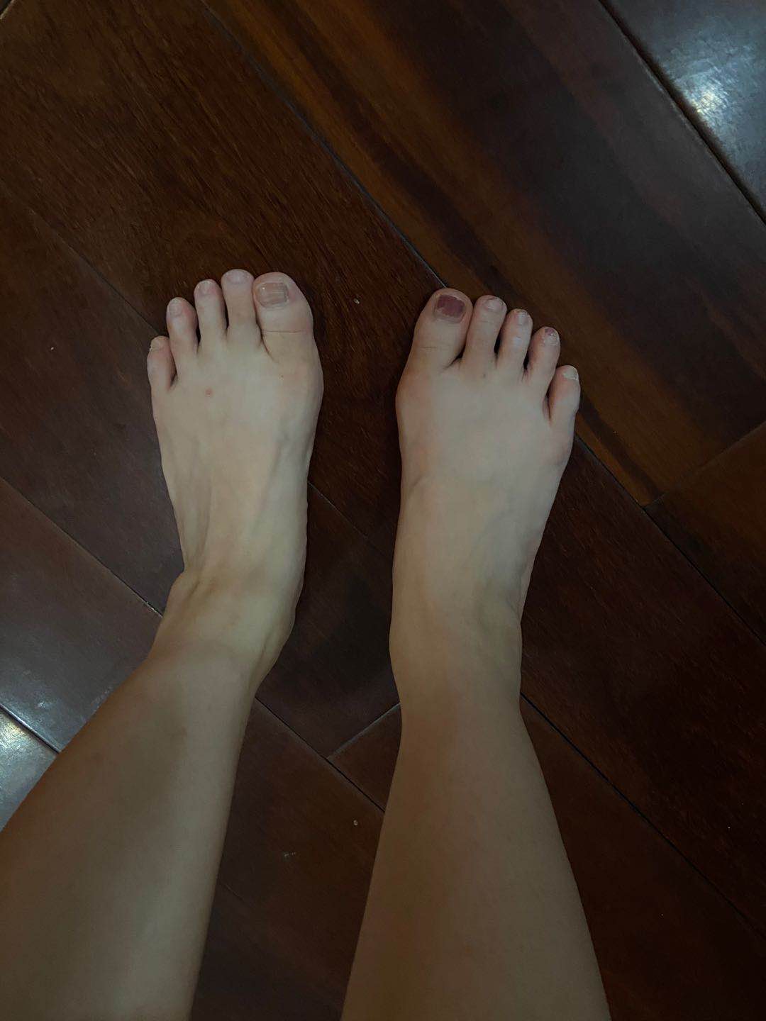 减肥后脚的鞋码会变小吗？我想要穿小码鞋子，可以吗