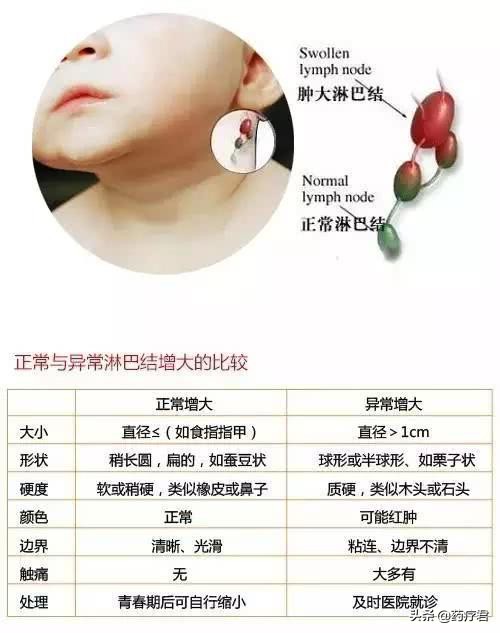 10岁孩子淋巴结肿大,竟有无知父母针扎肿块,看着都疼