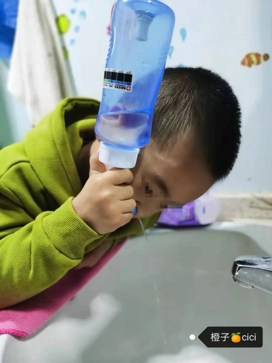 孩子鼻塞鼻炎反復不好，這個小方法最管用？
