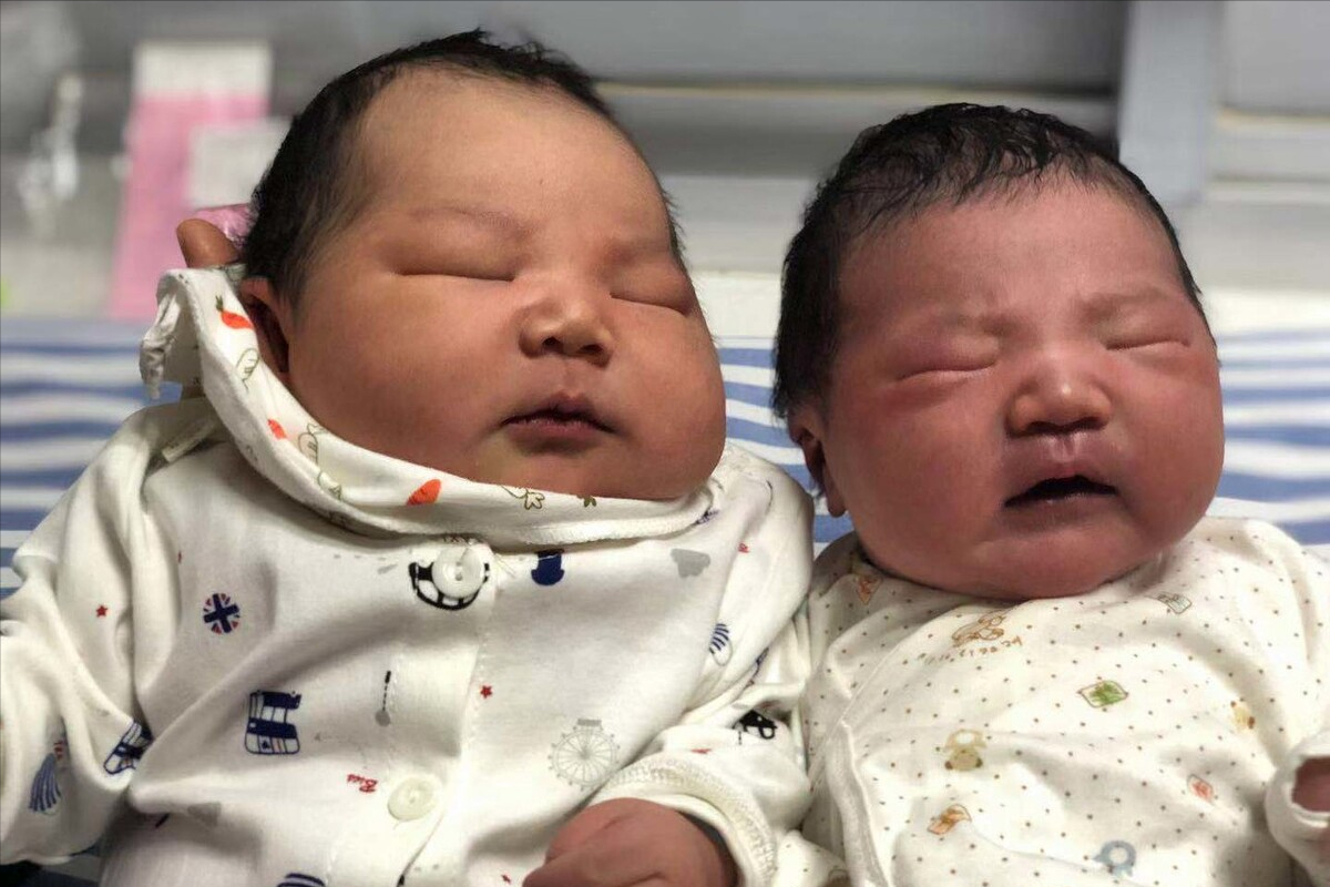 新生儿按需哺乳喂养指南