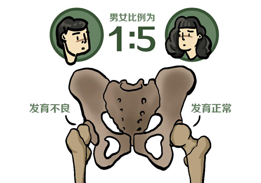 右胯骨疼是怎么回事女性(走路走久了胯耻骨就疼) - seo葵花宝典