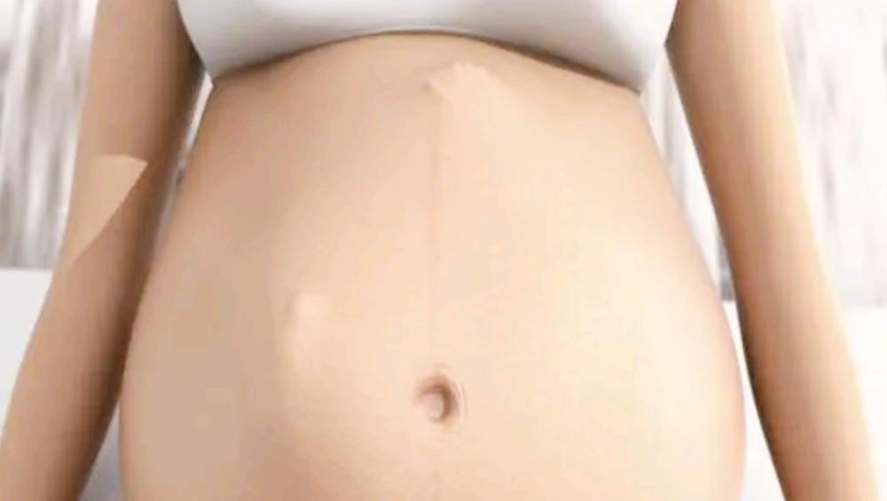 孕妈怀孕后,肚脐也发生了变化,“凸”出来的原因无外乎三种