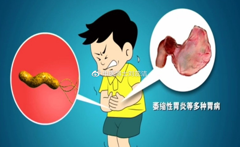 萎缩性胃炎能否逆转？胃萎缩治疗方法详解