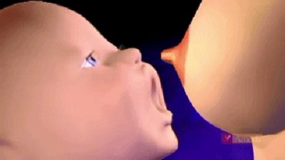 涨奶，堵奶，乳头破裂 , 乳腺炎，怎么办？