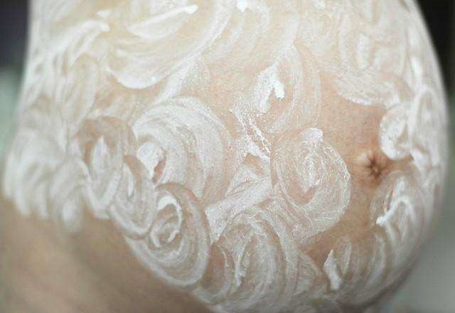 怀孕后肚皮上长“黑线”？准妈妈别苦恼，做好4件事有利于恢复