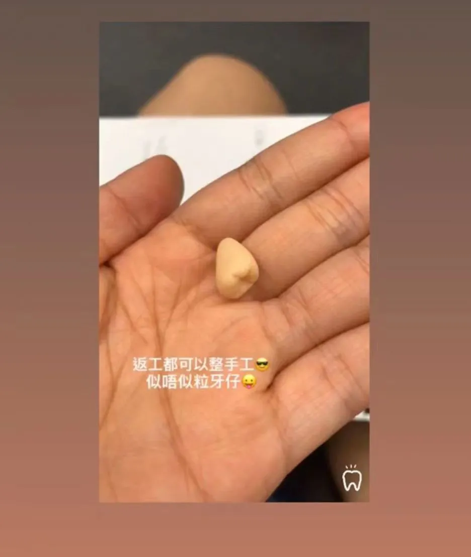 香港看牙避坑攻略!看牙到底有多贵?预约牙医要注意什么?