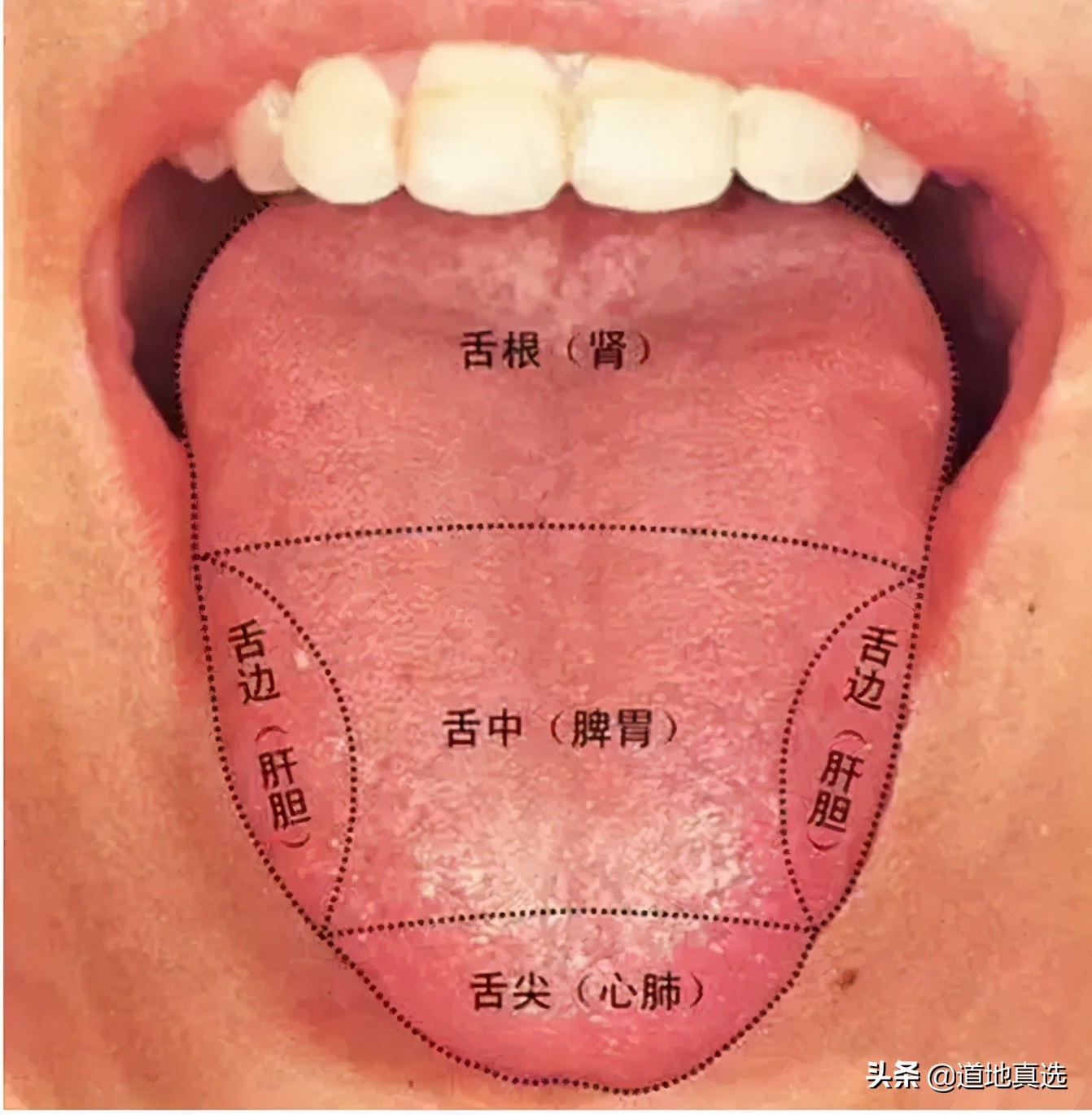 珍贵的舌诊图谱,看舌头知健康,人手一份!你也能快速识别疾病