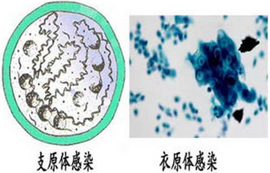 吃阿奇3天与5天后区别（阿奇3天吃法与5天吃法区别）-第3张图片-华展网