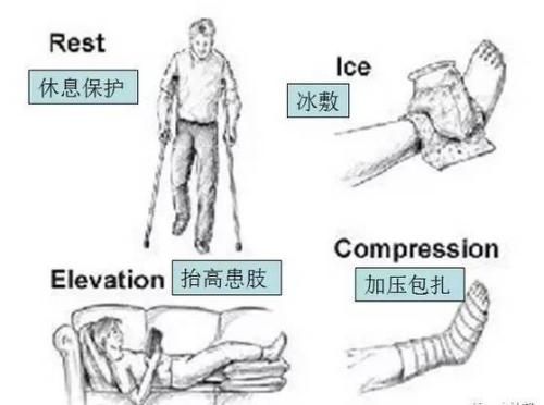 18岁的高三帅小伙，确诊没有骨折，骨科医生给他打了石膏