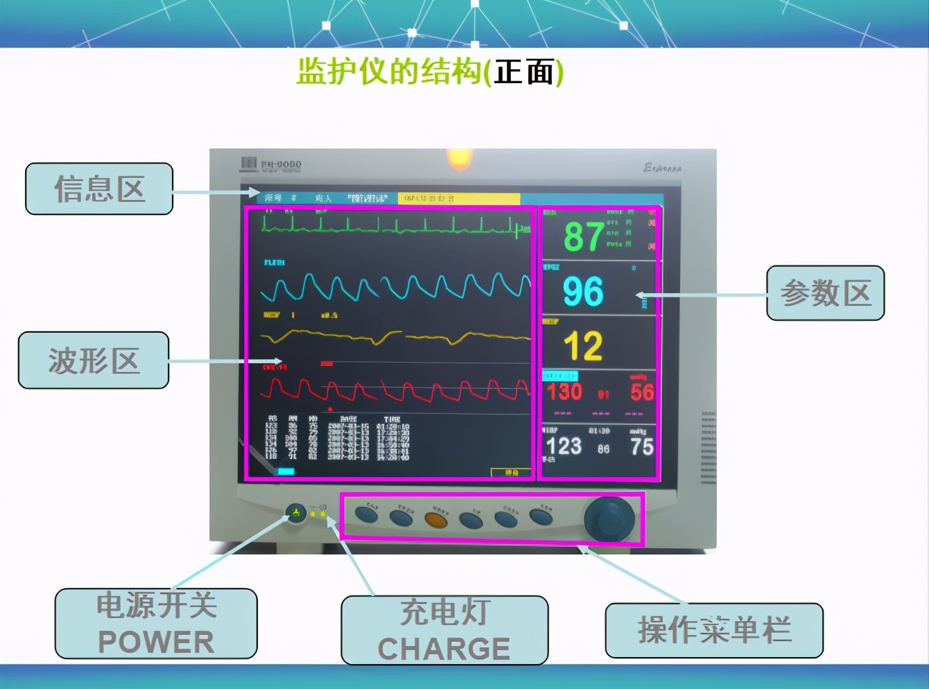 ecg监护仪上什么意思(ecg监护仪上什么意思正常值是多少) 