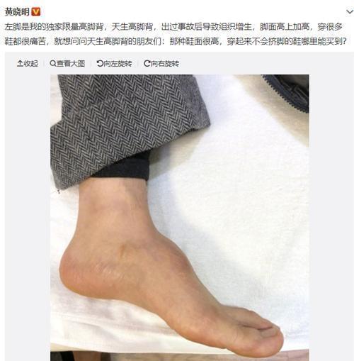 黄晓明因微博之夜一张合照，被曝穿增高垫，究竟是误会还是真相？