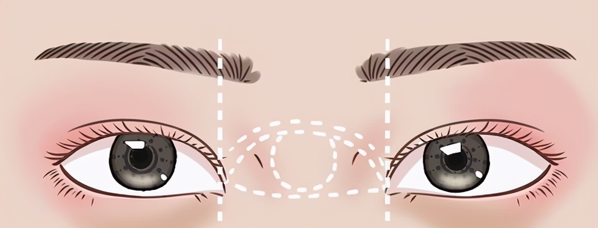 眼部整形不只是双眼皮，这些项目你了解过吗？