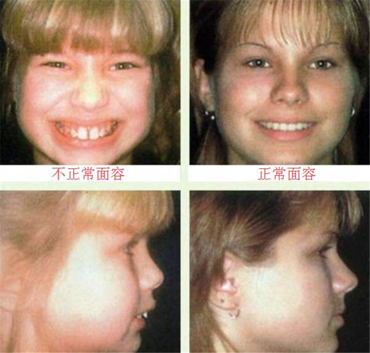儿子脸型像“大猩猩”，妈妈调侃“长残了”，朋友提醒才知不对劲
