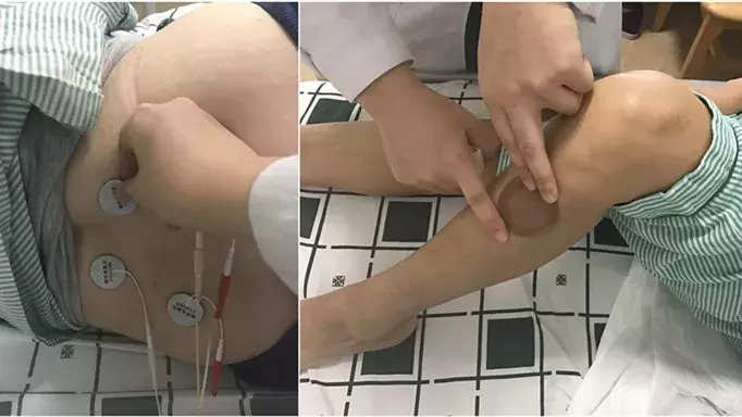 对子宫肌瘤Say NO