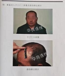 男子致人重伤，取保潜逃20年间多次返家，办了二代身份证和低保，一审获刑3年，被害人称量刑偏轻将上诉