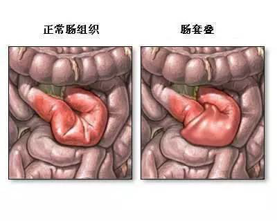 儿童呕吐是常见症状，除了感染因素，家长还要注意这些细节