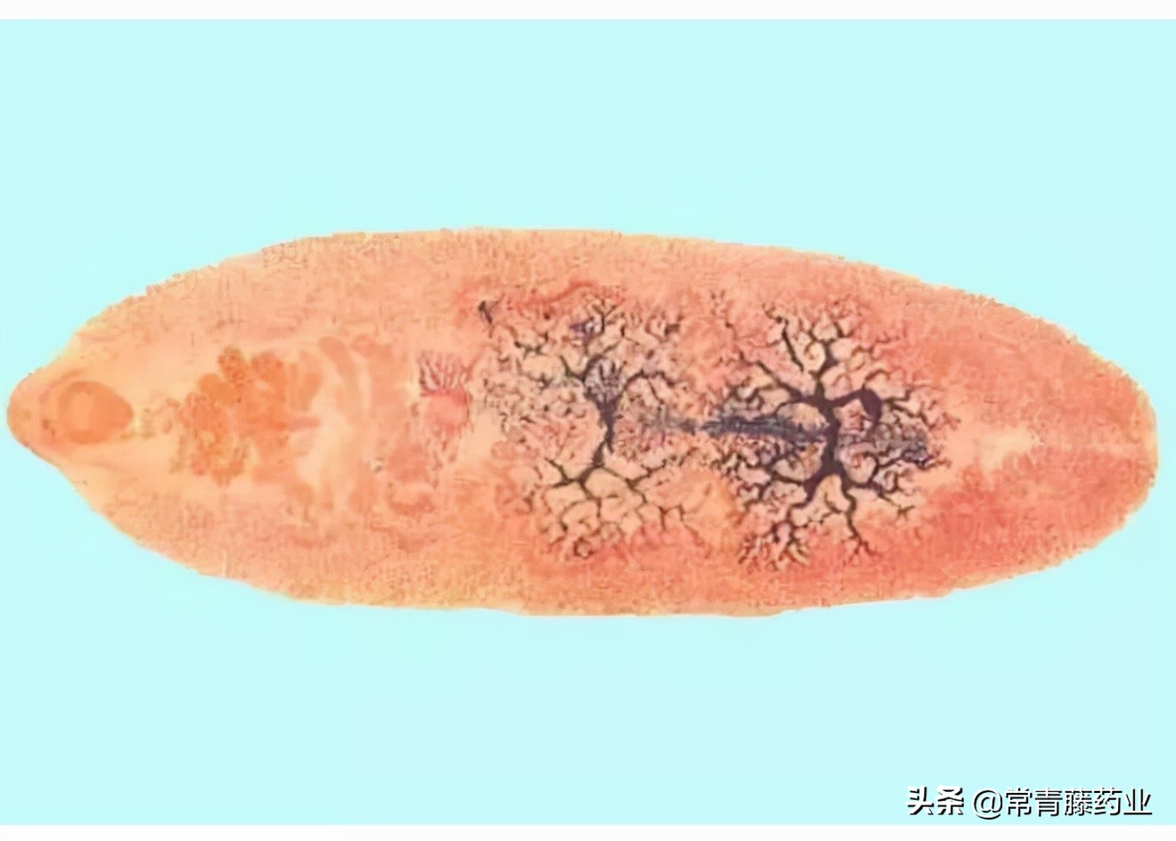 你还敢这样吃东西吗？盘点这些寄生虫，看看究竟有多恐怖