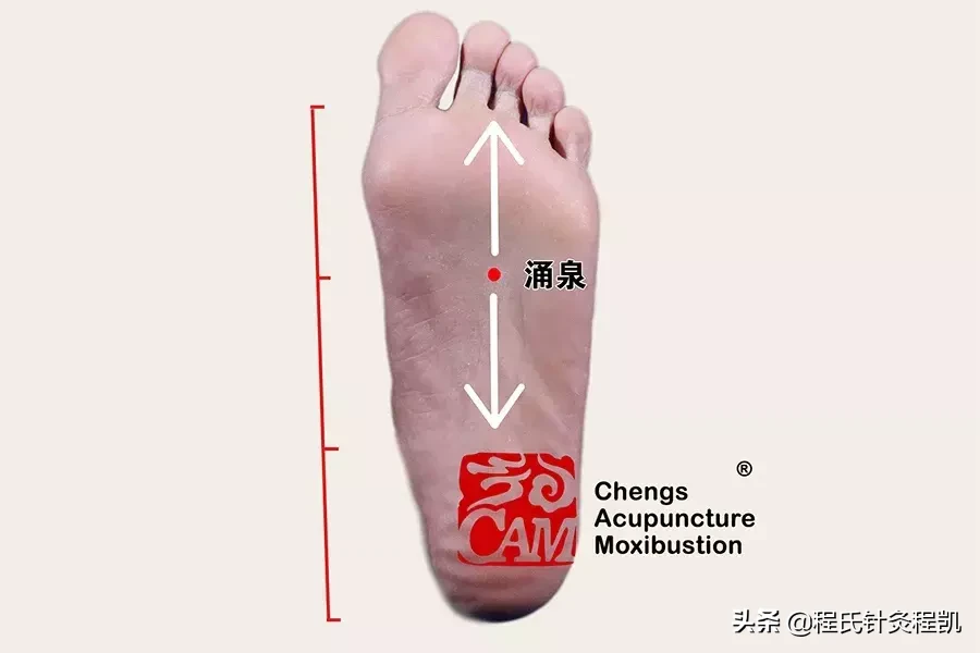答疑解惑 | 脑出血后遗症，左肢麻痛，按摩哪几个穴位能缓解痛苦
