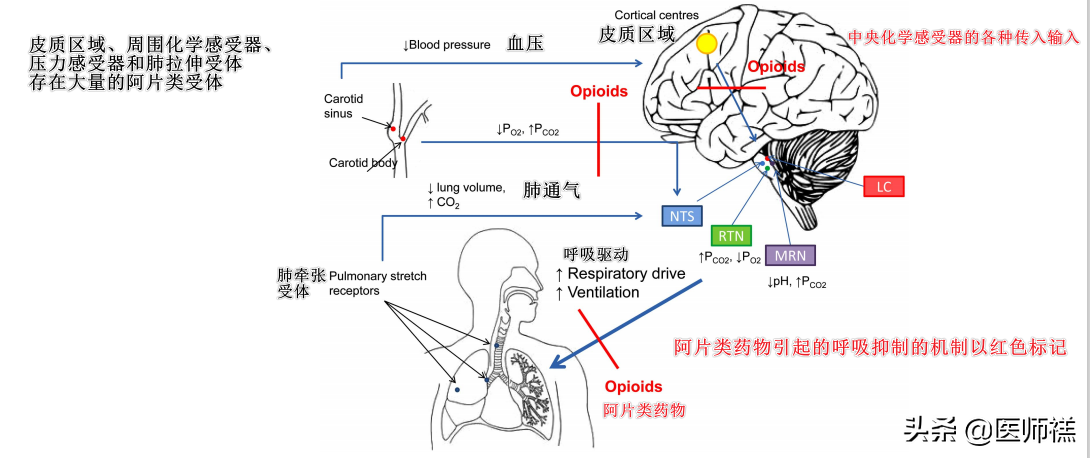 吃什么药快速致命死亡（吃什么毒药快速致死）-第3张图片-科灵网