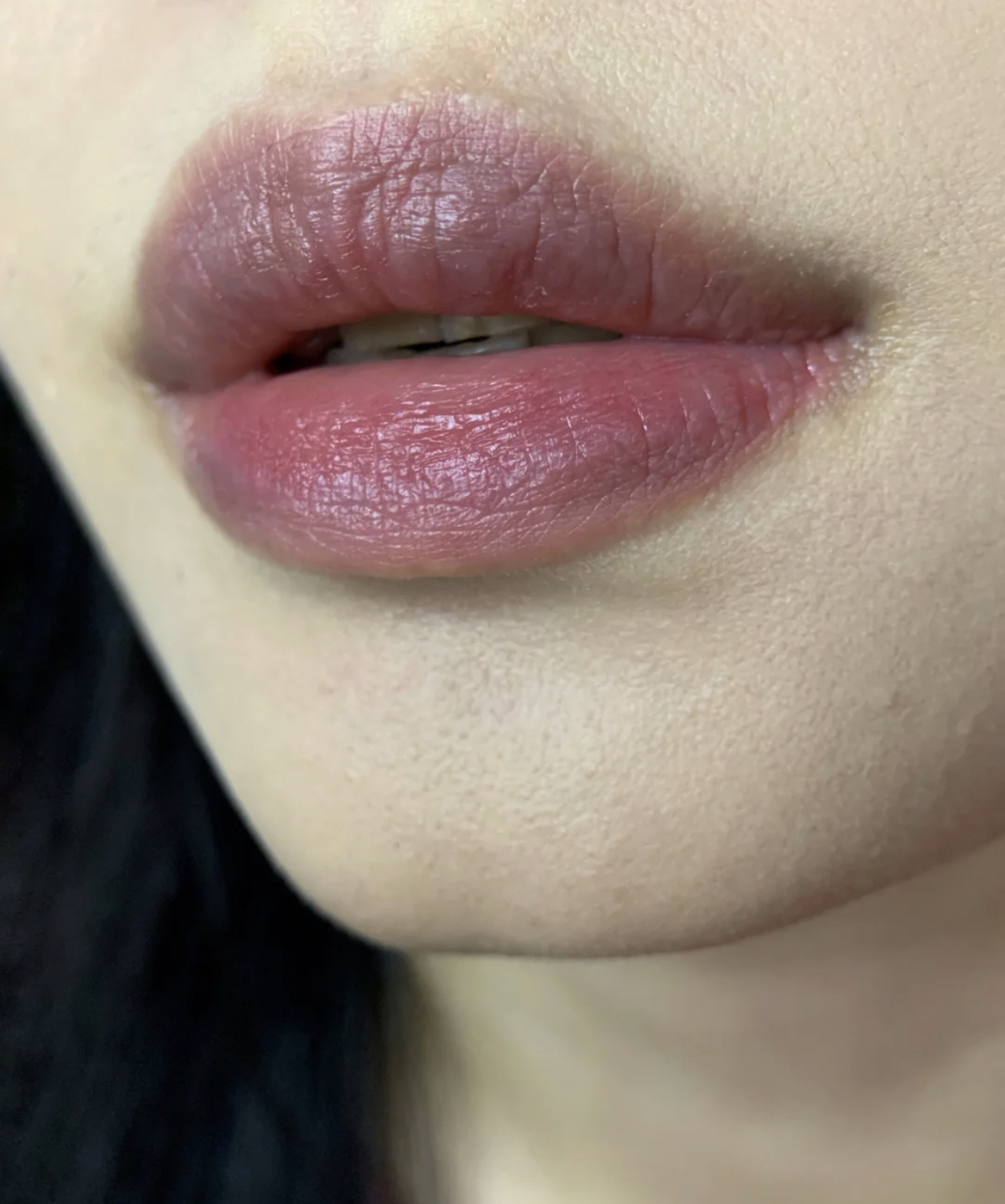 女人嘴唇发紫图片图片
