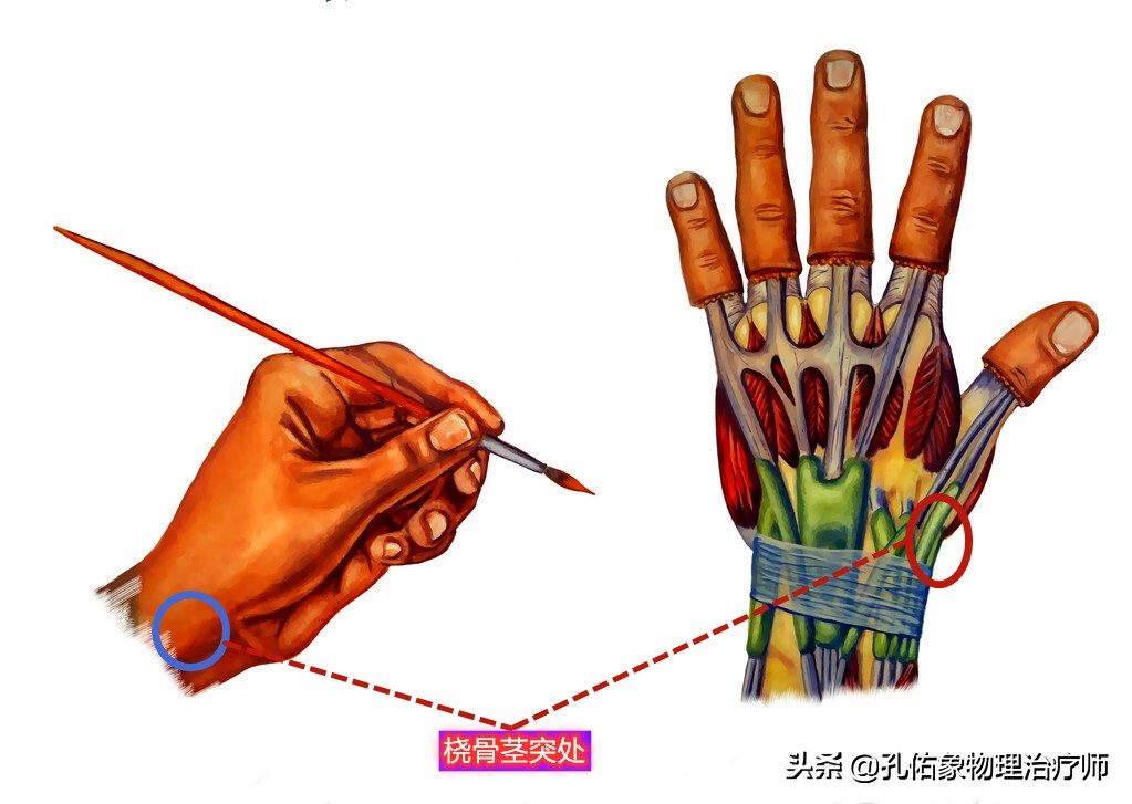 手指肿胀、僵硬、疼痛、有结节，挺挺就过去了？辟谣，趁早诊治