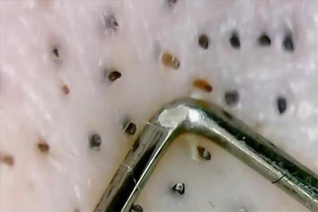 螨虫最怕这3种东西 螨虫用肉眼能看见吗-世界十大百科