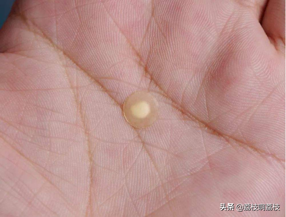 掏了室友脸上一颗大黑头，留了一个大洞，该怎么办？