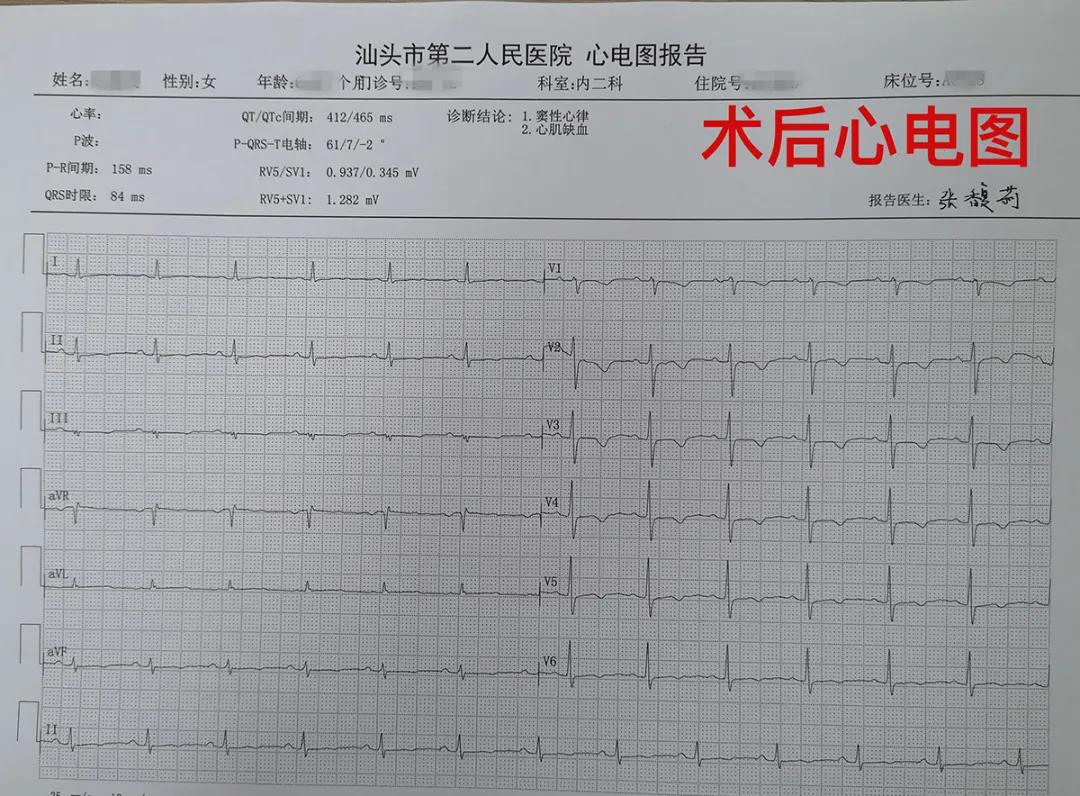 射频消融术让房颤患者重获“心”声