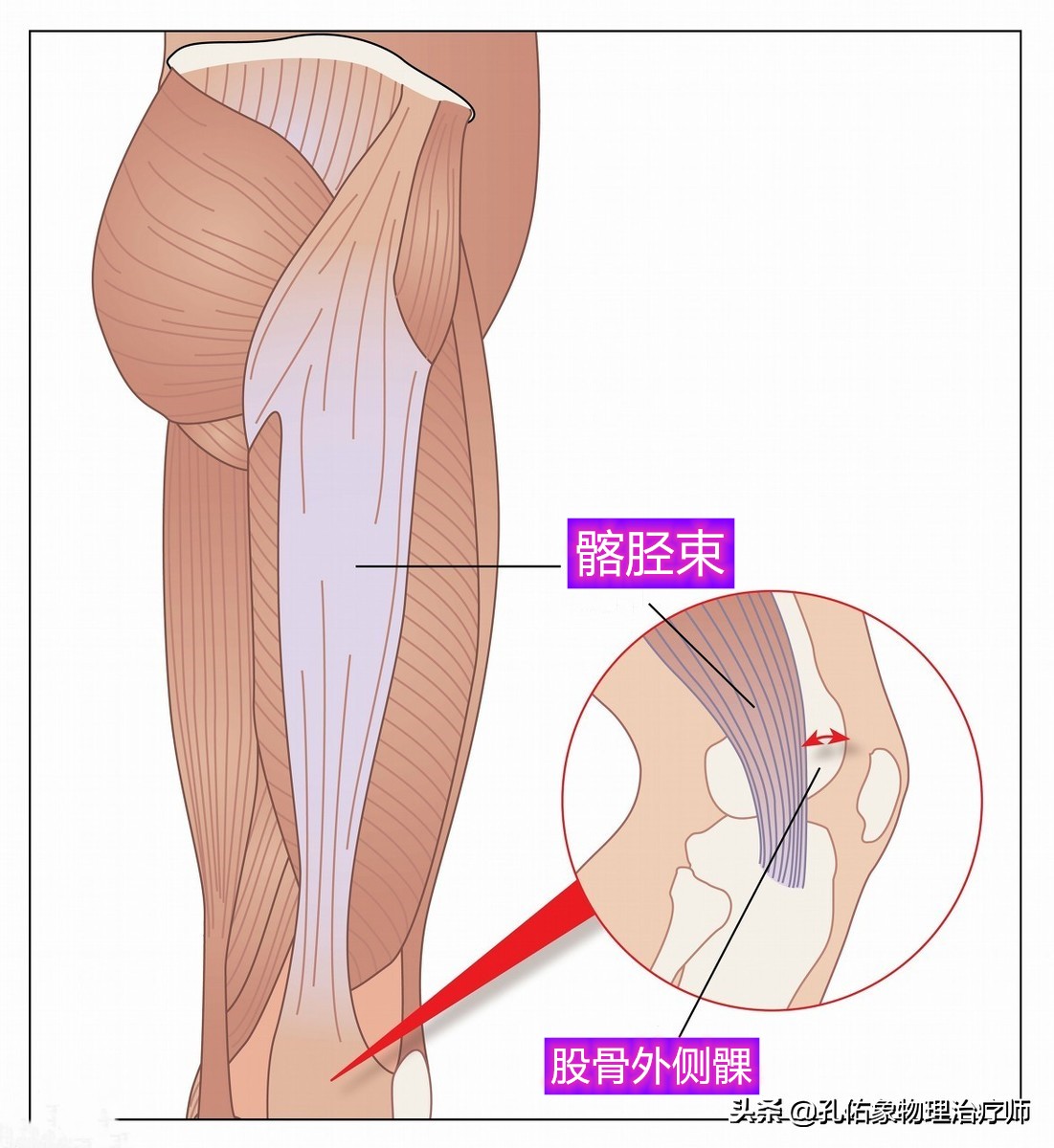 膝关节疼痛是怎么回事？常见的6个部位、8大病因，不可忽视