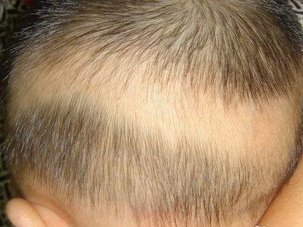 5个月孩子头发没长好,是缺钙吗?做好这些事长一头乌发不难