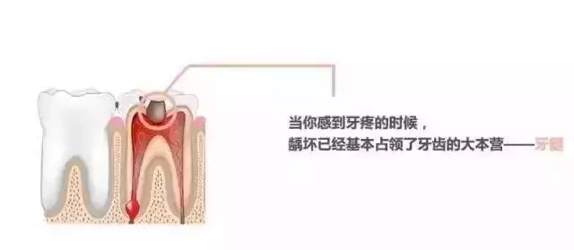 你补过牙吗？知道价格为什么差那么多吗？