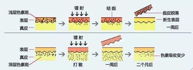 黑脸娃娃怎么做效果更好，做黑脸娃娃的步骤