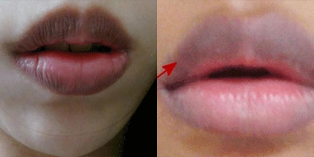 嘴唇是照妖镜,3种怪异颜色,很可能是患「大病」了,别拖延