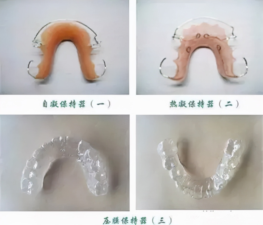 牙齒間隙保持器多少錢鄭州牙齒矯正蔡留意教授