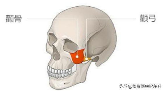 颧骨高，没有"好人缘"？可能是面部凹陷"惹的祸"...