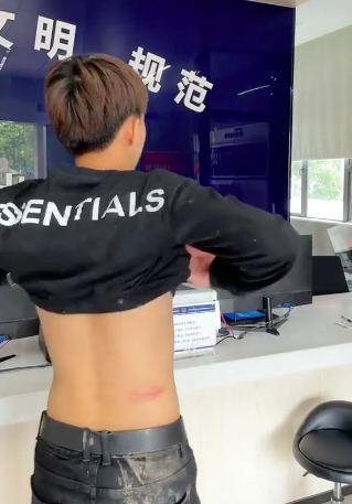 百万粉网红遭牌牌琦找人殴打，现身警局晒报告单，身上伤痕明显