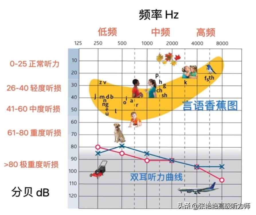 老年人要大声说话才能听见，配个助听器要多少钱？