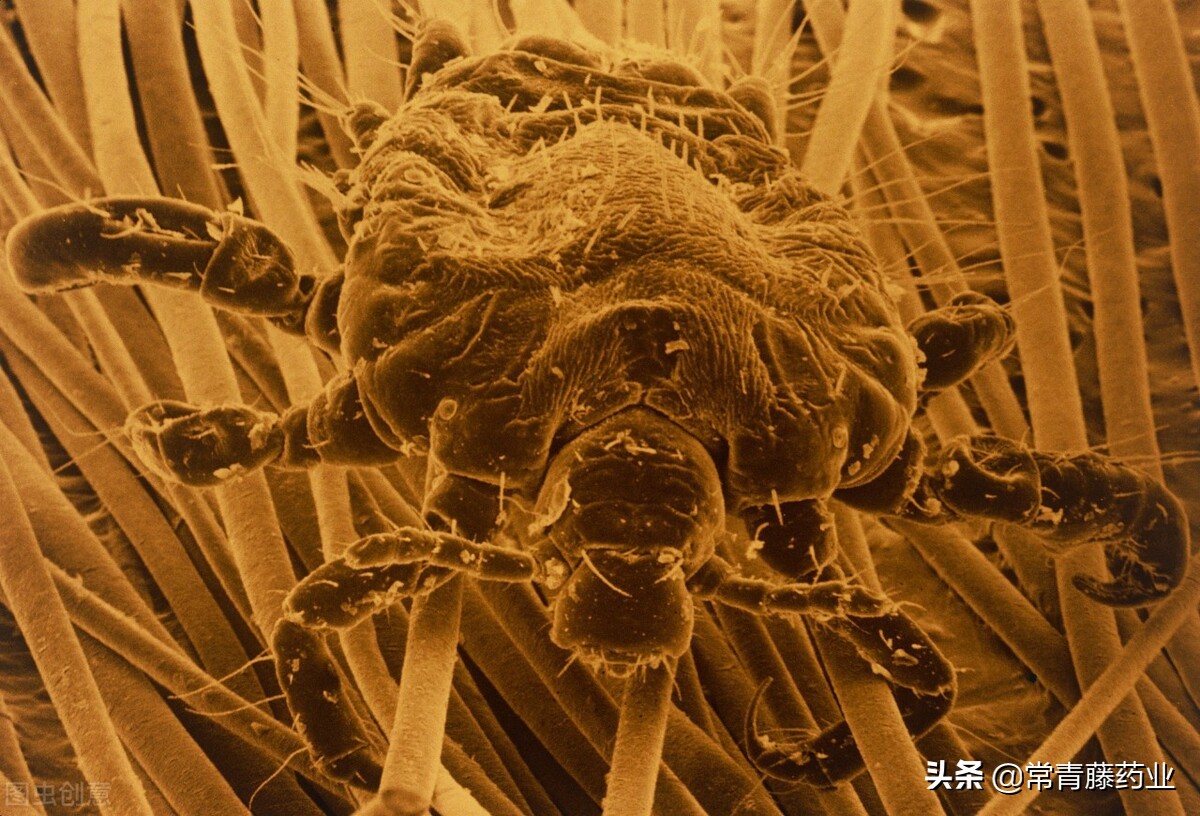 治疗阴虱会有什么误区?为什么会久治不愈?