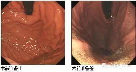 做胃镜到底有多难受？有风险吗？多久做一次合适？