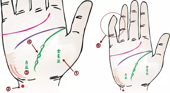 掌纹诊病：可以诊断肝癌、糖尿病、高血压、妇科病、脑溢血