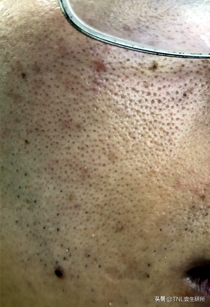 如何区分皂基洗面奶和氨基酸洗面奶？哪种更好用？