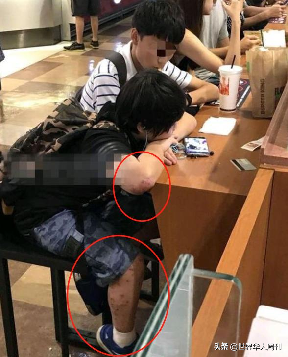 ​2岁出道年赚百万，被父母当提款机的童星小小彬，现状令人唏嘘