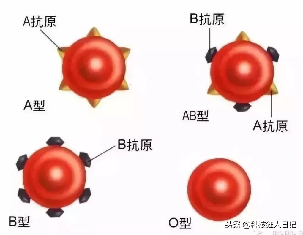 科学家最新发现：血型区别巨大，这个血型患病率明显偏低