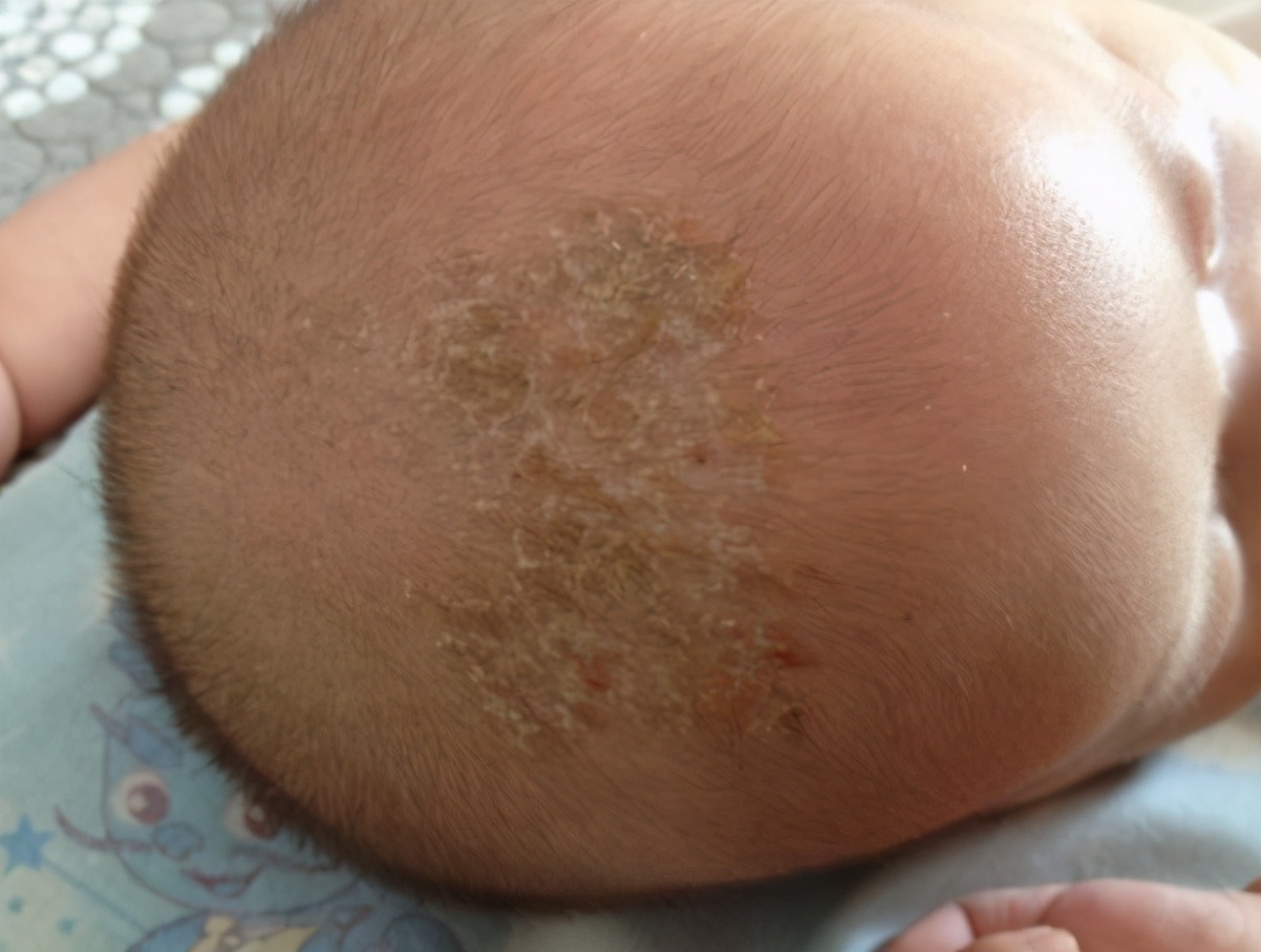 小王的儿子刚出生不久,浑身都是比较厚的胎脂,看起来非常别扭,不过