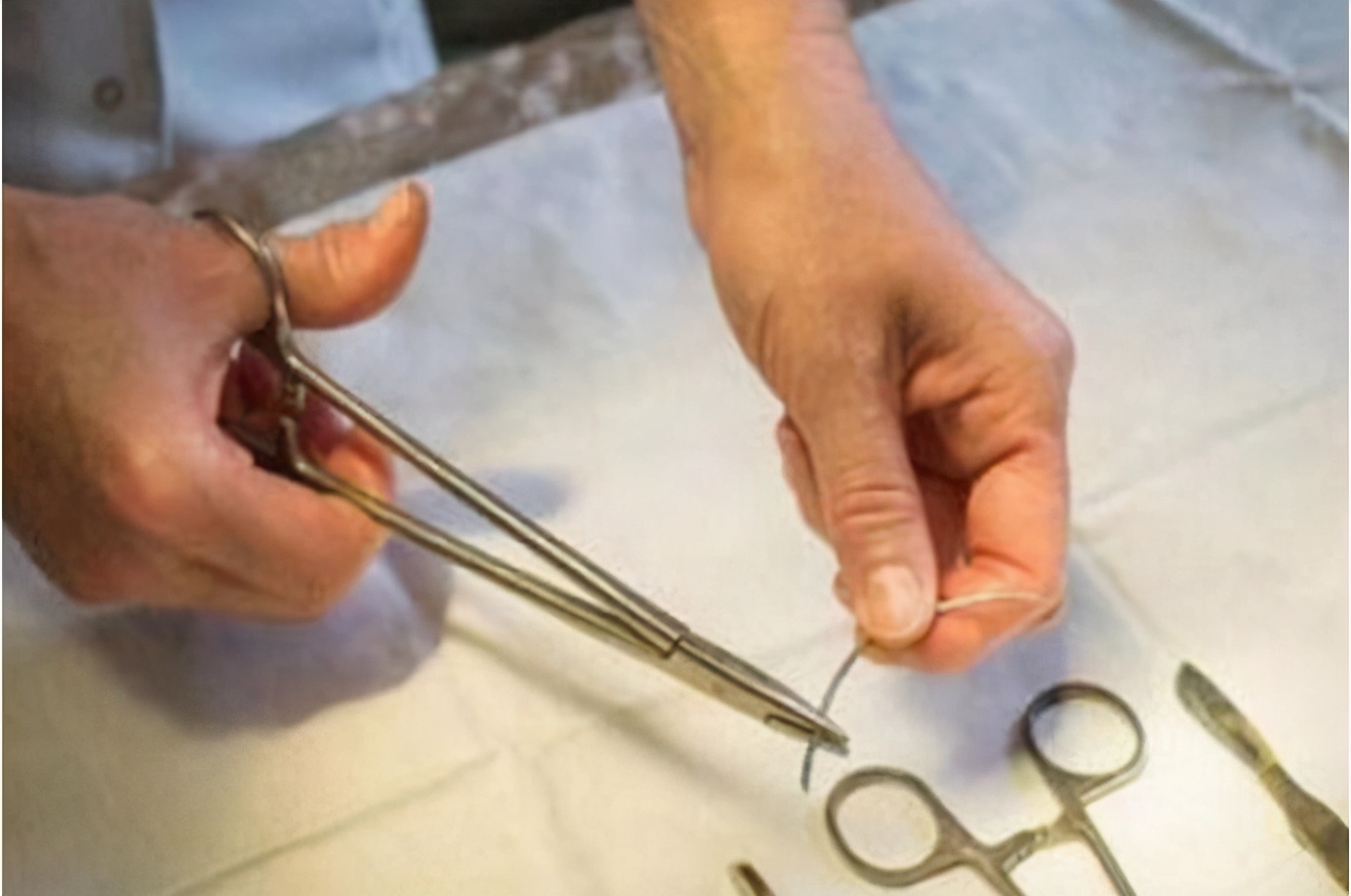 上环的价格国内首批