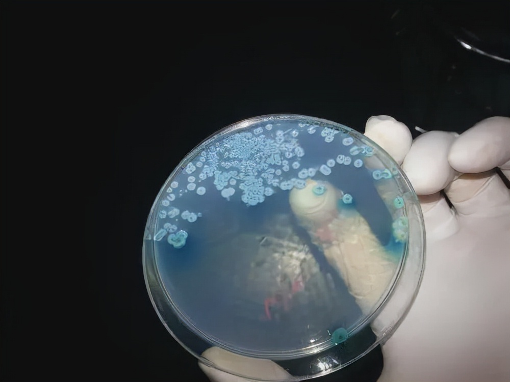 你真的了解弧菌吗？测弧菌的原理是什么？一文详细解答