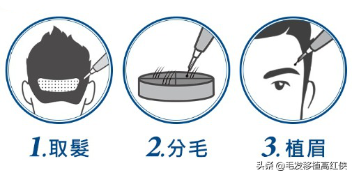 明星眉毛那么好看，是植眉还是纹眉