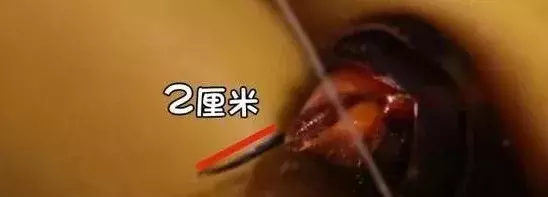 挖个坑,埋点土,秋后抬回两千万!蜂农中的绝命毒师